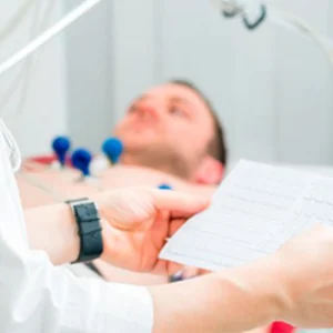 EKG – Lectura E Interpretación